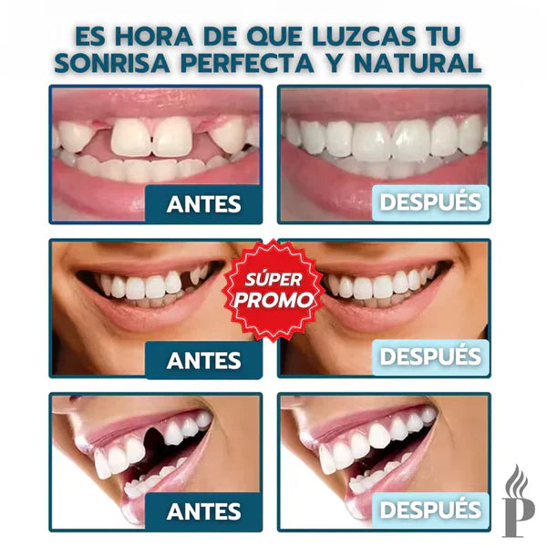 [PAGA 1 y LLEVA 2] CARILLAS DENTALES AJUSTABLES SNAP-ON SMILE