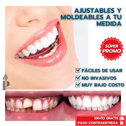 [PAGA 1 y LLEVA 2] CARILLAS DENTALES AJUSTABLES SNAP-ON SMILE