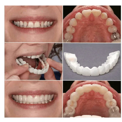 [PAGA 1 y LLEVA 2] CARILLAS DENTALES AJUSTABLES SNAP-ON SMILE